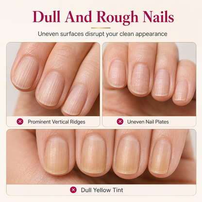 🎁Gift Idea Hot Sale 50% OFF🎁 Smooth Nail Ridges Instantly! Natural Ridge Filler
